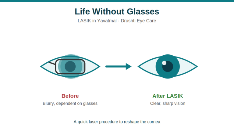 lasik-surgery-yavatmal.png